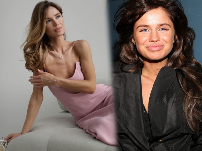 Александра чвикова пластика