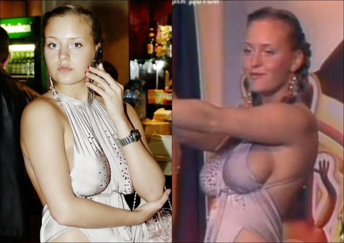 Надежда игошина ангина