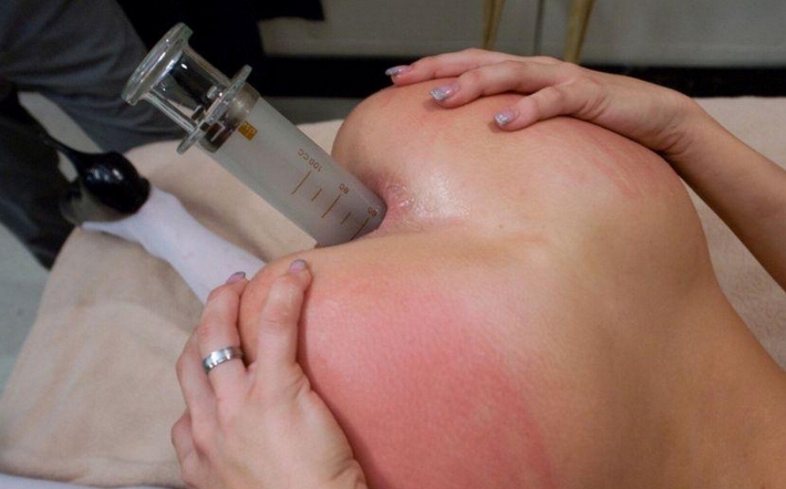 Стеклянные шприцы