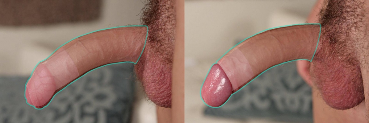 Обрезанные член