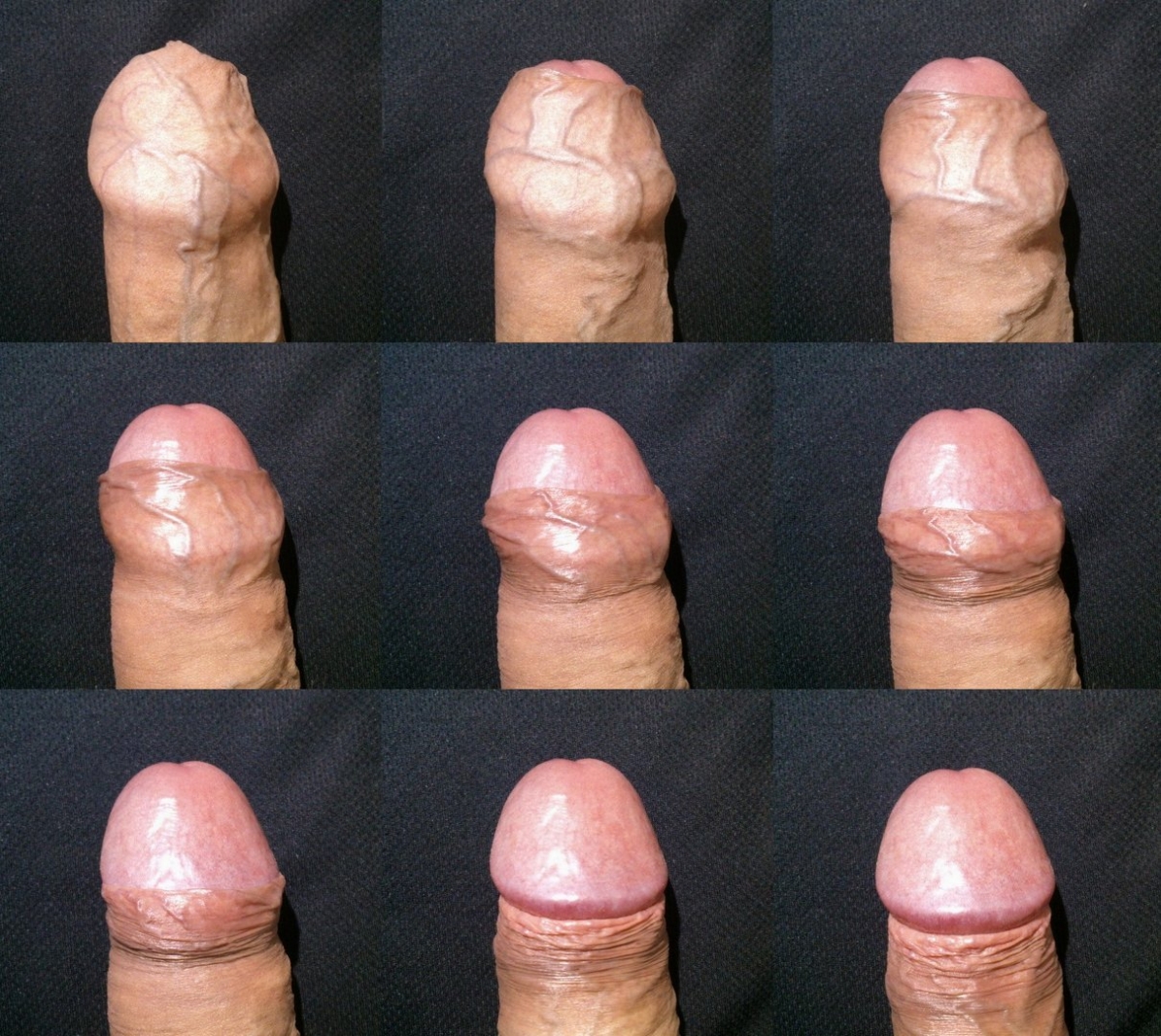 Голова в разных ракурсах